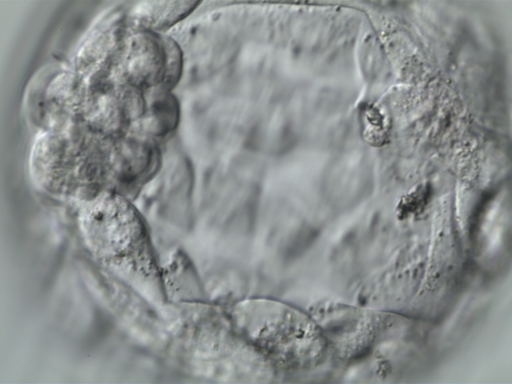 Blastocyst embryo under microscopy